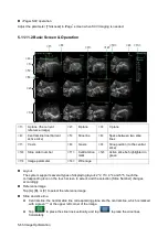 Preview for 144 page of Mindray Resona 7 Operator'S Manual