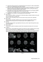 Preview for 145 page of Mindray Resona 7 Operator'S Manual