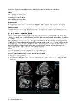 Preview for 150 page of Mindray Resona 7 Operator'S Manual