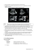 Preview for 151 page of Mindray Resona 7 Operator'S Manual