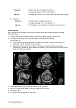 Preview for 152 page of Mindray Resona 7 Operator'S Manual