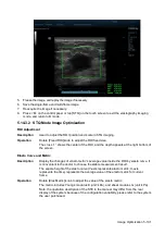 Preview for 177 page of Mindray Resona 7 Operator'S Manual