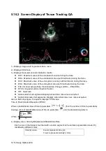 Preview for 190 page of Mindray Resona 7 Operator'S Manual