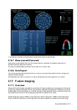 Preview for 195 page of Mindray Resona 7 Operator'S Manual