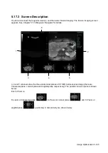 Preview for 201 page of Mindray Resona 7 Operator'S Manual