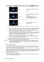 Preview for 204 page of Mindray Resona 7 Operator'S Manual