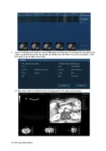 Preview for 208 page of Mindray Resona 7 Operator'S Manual