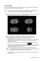 Preview for 209 page of Mindray Resona 7 Operator'S Manual