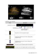 Preview for 213 page of Mindray Resona 7 Operator'S Manual