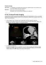 Preview for 215 page of Mindray Resona 7 Operator'S Manual