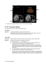 Preview for 216 page of Mindray Resona 7 Operator'S Manual