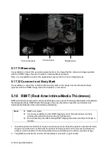 Preview for 220 page of Mindray Resona 7 Operator'S Manual