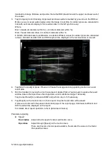 Preview for 222 page of Mindray Resona 7 Operator'S Manual