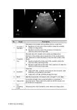 Preview for 384 page of Mindray Resona 7 Operator'S Manual