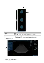 Preview for 426 page of Mindray Resona 7 Operator'S Manual