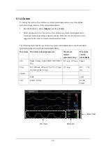 Preview for 62 page of Mindray SynoVent E5 Operator'S Manual