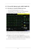 Preview for 115 page of Mindray uMEC10 Operator'S Manual