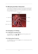 Preview for 156 page of Mindray uMEC10 Operator'S Manual