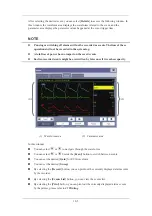 Preview for 171 page of Mindray uMEC10 Operator'S Manual