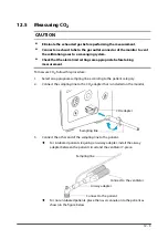 Preview for 135 page of Mindray VS 8A Operator'S Manual