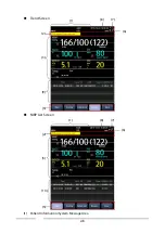 Preview for 28 page of Mindray VS-900 Operator'S Manual