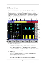 Preview for 37 page of Mindray WATO EX-65 Operator'S Manual