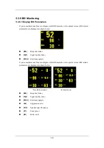 Preview for 80 page of Mindray WATO EX-65 Operator'S Manual