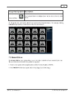 Предварительный просмотр 55 страницы Minicat xoran User Manual