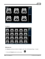 Предварительный просмотр 62 страницы Minicat xoran User Manual