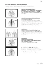 Предварительный просмотр 17 страницы Morita DENTA PORT ZX Operation Instructions Manual