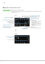 Preview for 20 page of Morita Signo T500 Operation Instructions Manual