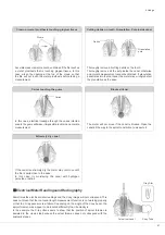 Preview for 43 page of Morita Signo T500 Operation Instructions Manual