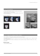 Preview for 13 page of Morita Veraview X800 Instructions For Use Manual