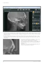 Preview for 28 page of Morita Veraview X800 Instructions For Use Manual