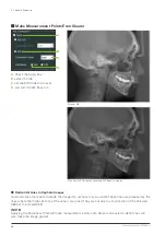 Preview for 38 page of Morita Veraview X800 Instructions For Use Manual