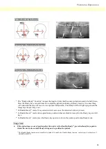 Preview for 39 page of Morita veraviewepocs 2d Instructions For Use Manual