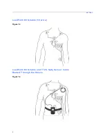 Предварительный просмотр 24 страницы Mortara T12 User Manual