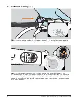 Предварительный просмотр 12 страницы Motus Pure-Vu System Instructions For Use Manual