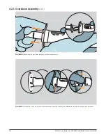 Предварительный просмотр 13 страницы Motus Pure-Vu System Instructions For Use Manual