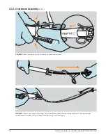 Предварительный просмотр 14 страницы Motus Pure-Vu System Instructions For Use Manual