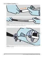 Предварительный просмотр 15 страницы Motus Pure-Vu System Instructions For Use Manual