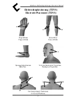 Предварительный просмотр 92 страницы MTR MyoBravo Operator'S Manual