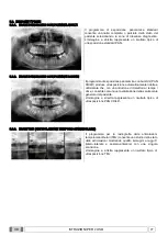 Preview for 104 page of Myray 708G Operator'S Manual