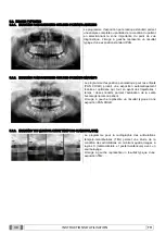 Preview for 169 page of Myray 708G Operator'S Manual