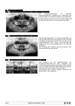 Preview for 235 page of Myray 708G Operator'S Manual