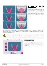 Preview for 240 page of Myray 708G Operator'S Manual