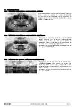 Preview for 300 page of Myray 708G Operator'S Manual