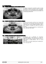 Preview for 365 page of Myray 708G Operator'S Manual