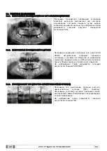 Preview for 430 page of Myray 708G Operator'S Manual