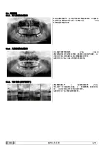 Preview for 560 page of Myray 708G Operator'S Manual